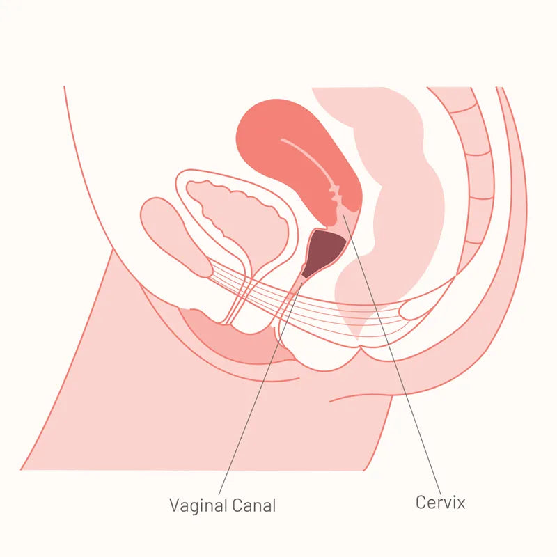 Copo vaginal em silicone para retenção menstrual
